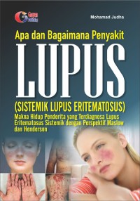 Apa dan Bagaimana Penyakit Lupus (Sistemik Lupus Eritematosus)